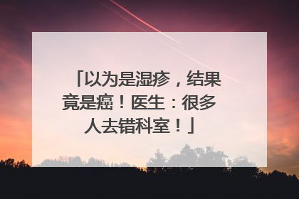 以为是湿疹，结果竟是癌！医生：很多人去错科室！